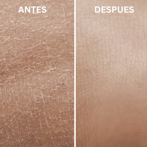 Guante Exfoliante MandalalolGlo